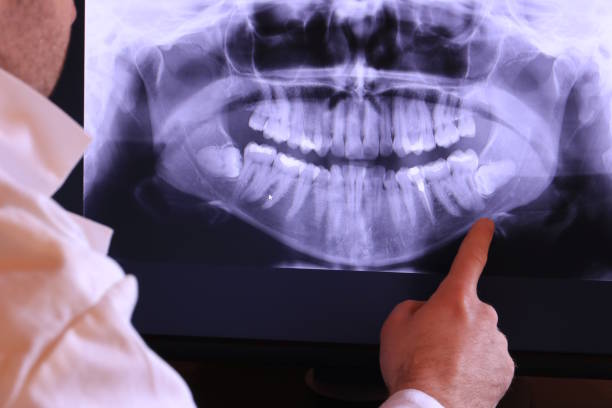 Best Walk-In Emergency Dentist in Stallion Springs, CA