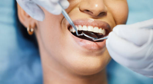 Best Emergency Broken Tooth Repair in Stallion Springs, CA